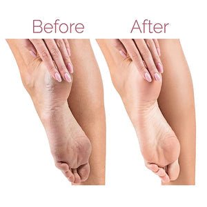 ELECTRIC PEDICURE FOOT FILE CALLUS REMOVER - emirate deals